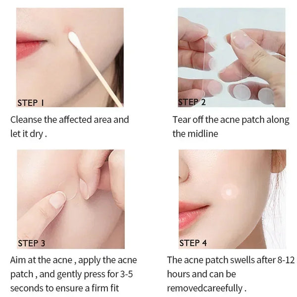 72-720Pcs-Invisible-Acne-Patches-Removal-Pimple-Anti-Acne-Hydrocolloid-Patches-Spots-Marks-Concealer-Repair-Sticker.jpg
